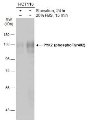 Western Blot: PYK2/FAK2 [p Tyr402] Antibody [NBP3-13314]